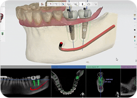 짧은 수술 시간 높은 완성도